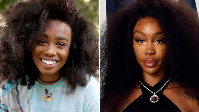 sza before surgery